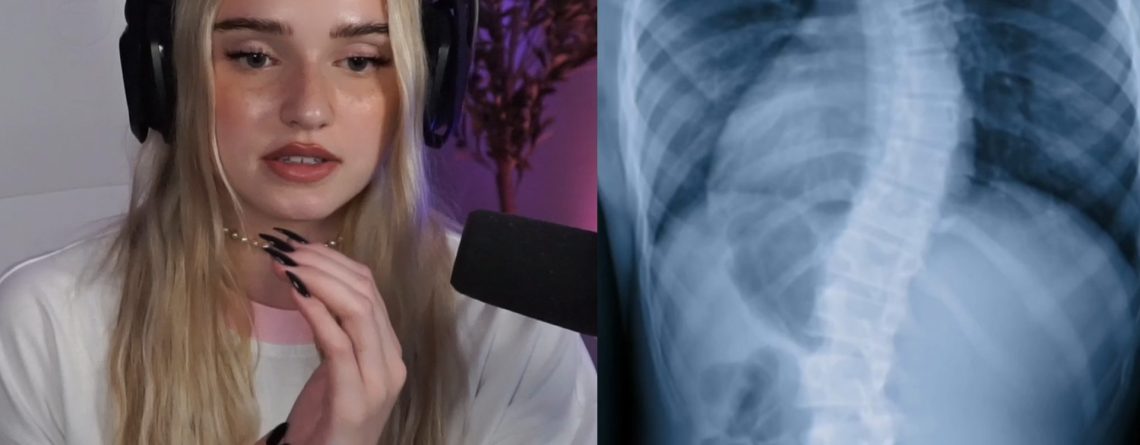 Eine der größten deutschen Twitch-Streamerinnen spricht offen über ihre Erkrankung und zeigt die Auswirkungen davon