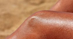 Titelbild Sonnenbrand Haut