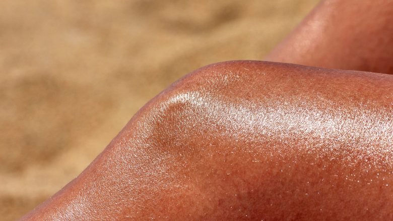 Gen Z is currently competing for the worst sunburn and doesn’t even know how dangerous it is