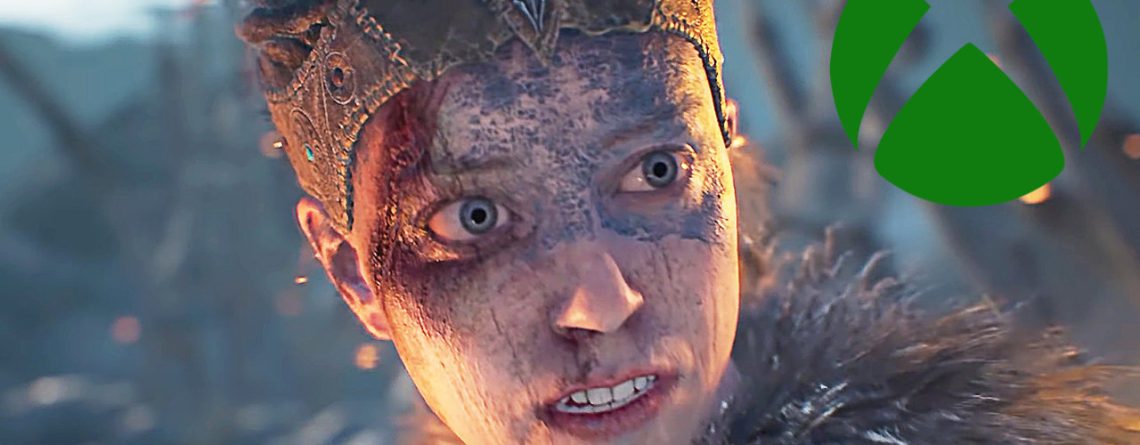 Betroffene von Xbox nächster Massenentlassung wollen keine „Wegwerfware“ sein, wehren sich gegen die Schließung ihrer Studios